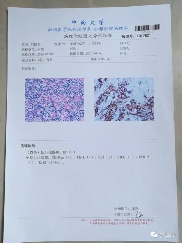 我岳父大人的胃癌有没有更好的治疗方案