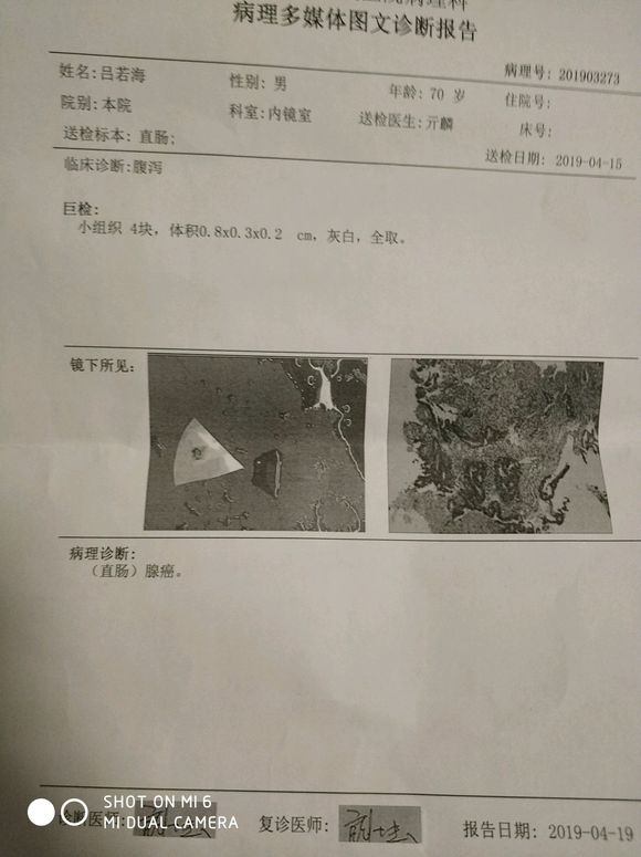 爷爷70岁了，还能做手术吗?这个算早期还是晚期呀?