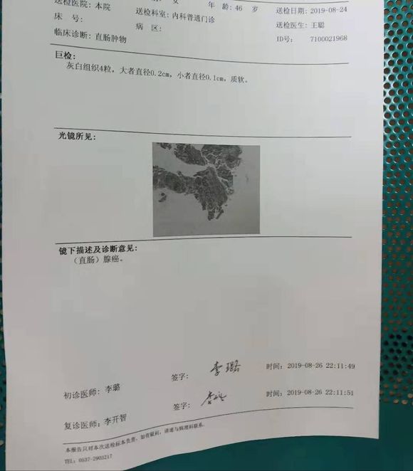 直肠腺癌能帮忙看看这个病理