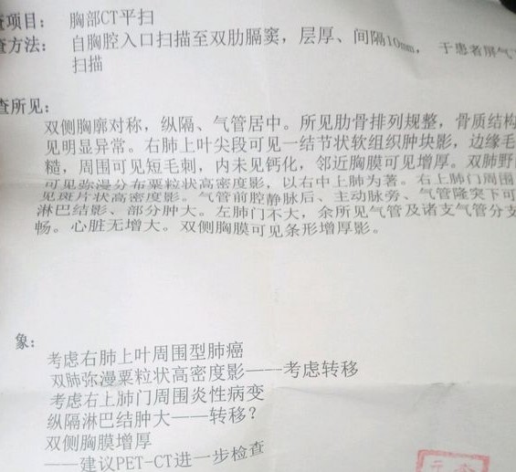 27岁女肝癌中晚期？