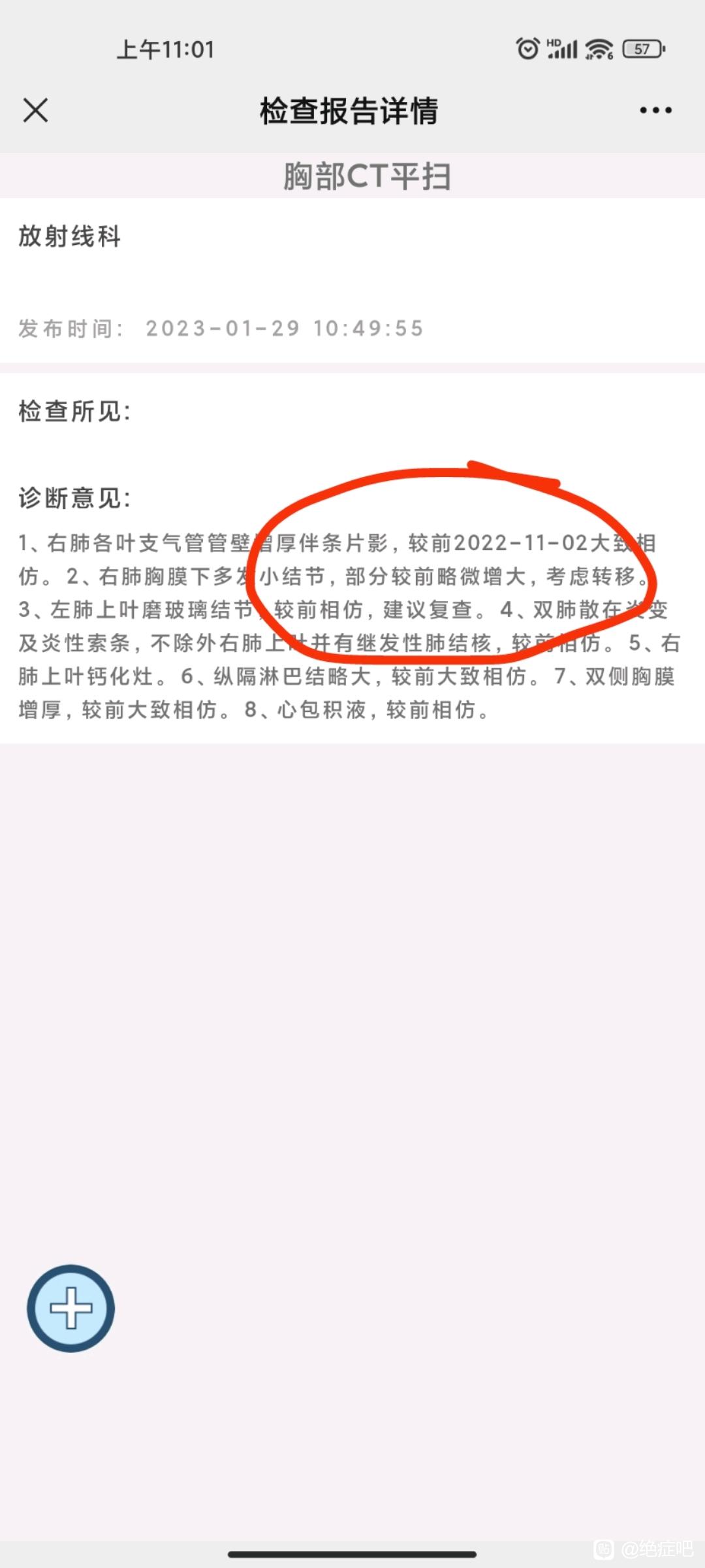 肺腺癌四期，858突变凯美纳39个月缓慢耐药