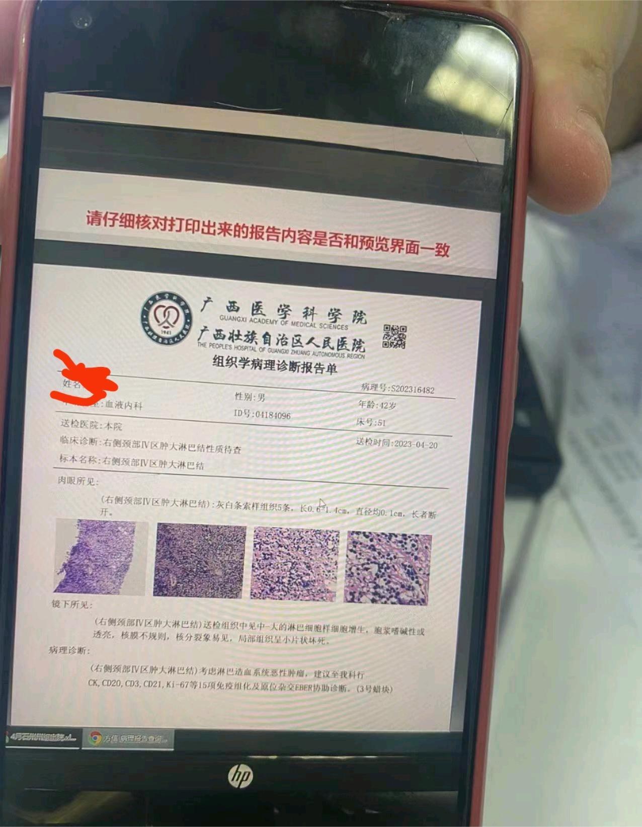 幫我看看，這個救活的可能性多大