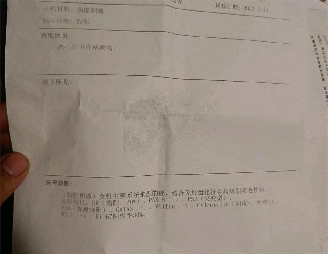 腹腔积液，肿瘤